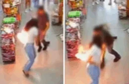 VEJA VÍDEO: jovem que se queimou após celular pegar fogo no bolso vai ter que fazer raspagem