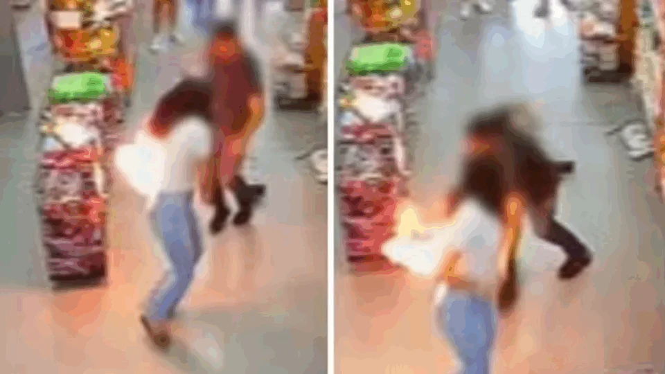 VEJA VÍDEO: jovem que se queimou após celular pegar fogo no bolso vai ter que fazer raspagem