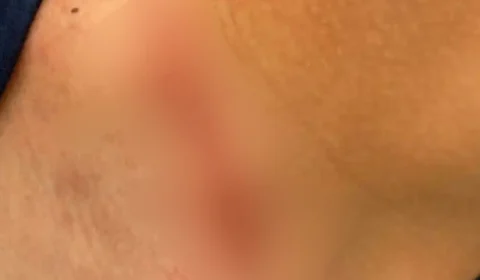 Professor é denunciado por agredir aluno especial de 13 anos em escola de Minas Gerais