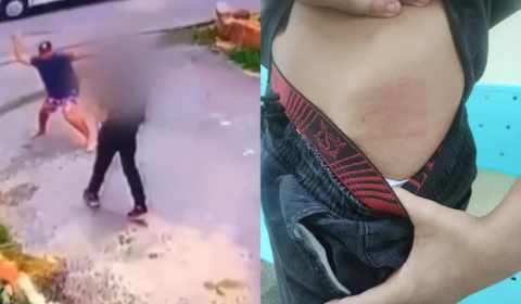 ‘Ele me chamou de bandido da boca’, afirma aluno autista agredido no Colônia Terra Nova