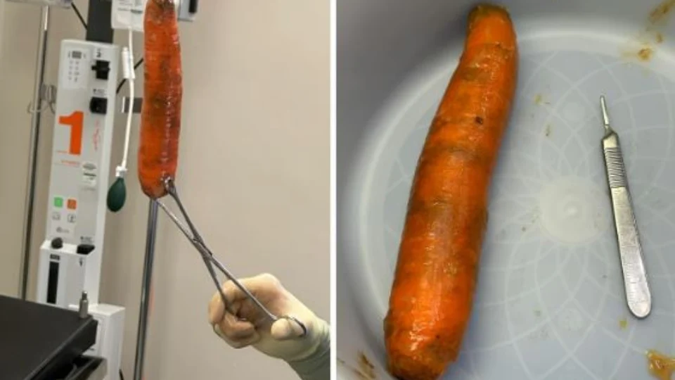 Homem procura emergência após introduzir uma cenoura no canal retal