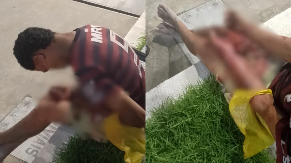 Homem é baleado na mão após tentativa de roubo em Manaus