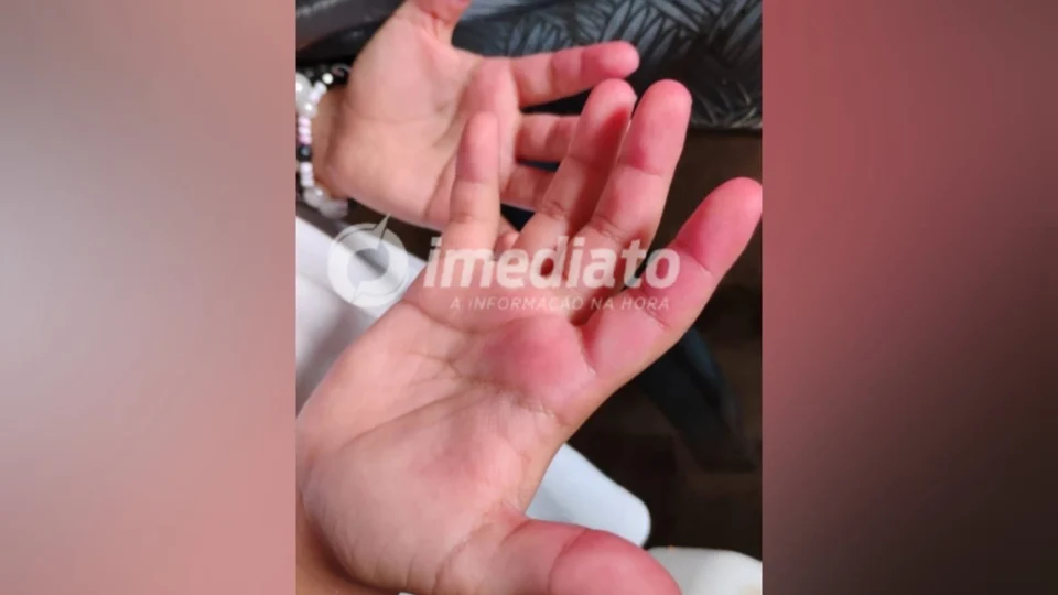 Mãe denuncia professor por agressão contra filha de 8 anos em escola em Manaus