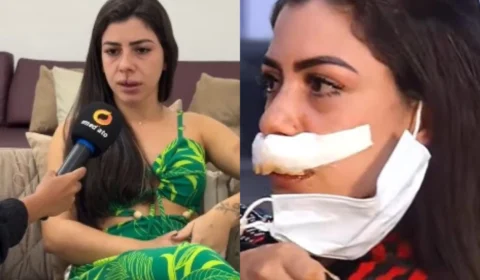 Homem é procurado após brutal agressão contra promotora de eventos em Manaus
