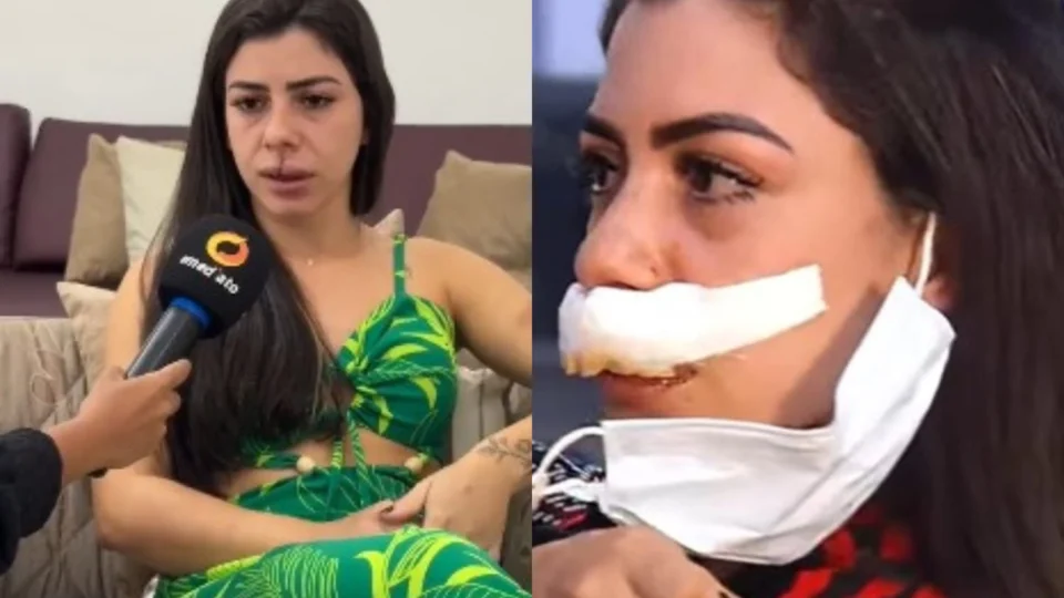Homem é procurado após brutal agressão contra promotora de eventos em Manaus