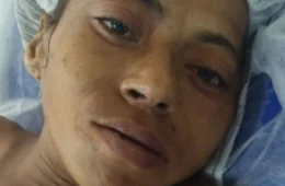 HPS João Lúcio busca família de mulher internada após cair de escada em Manaus