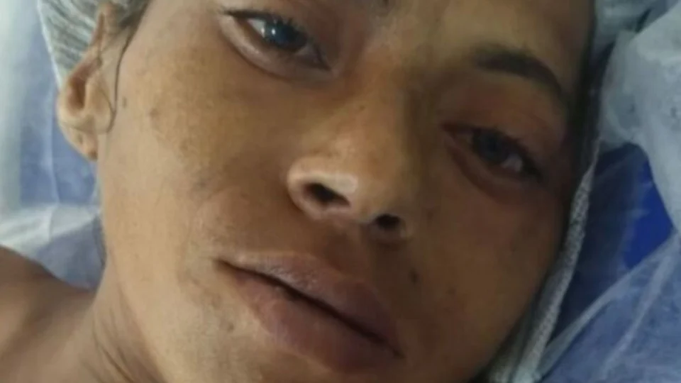 HPS João Lúcio busca família de mulher internada após cair de escada em Manaus