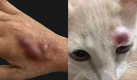 Especialista chama a atenção para aumento dos casos de esporotricose