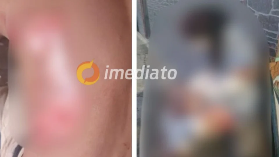 VEJA VÍDEO: ‘rolezinho’ de motos termina em grave acidente após fuga de viatura policial em Manaus