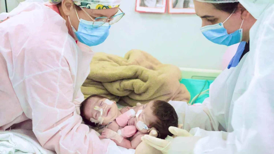 Cirurgia de separação de gêmeas siamesas do Amazonas é bem-sucedida em Goiânia