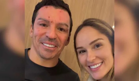 Ex-Zagueiro Lúcio aparece sorridente em foto no hospital após acidente com lareira ecológica