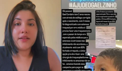 “Gael não pode esperar”: bebê com 90% da traqueia obstruída precisa de cirurgia urgente e mãe faz apelo nas redes
