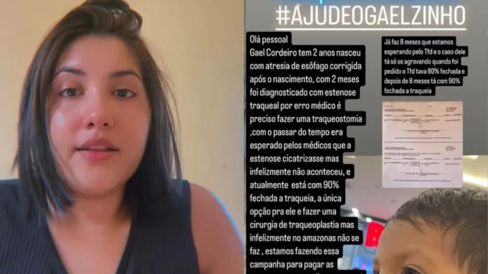“Gael não pode esperar”: bebê com 90% da traqueia obstruída precisa de cirurgia urgente e mãe faz apelo nas redes