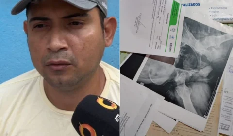 Homem espera há 5 anos por cirurgia ortopédica e teme perder os movimentos