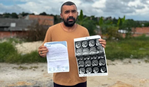 Há dois anos na fila do SUS, jovem com malformação cerebral faz apelo por cirurgia em Manaus