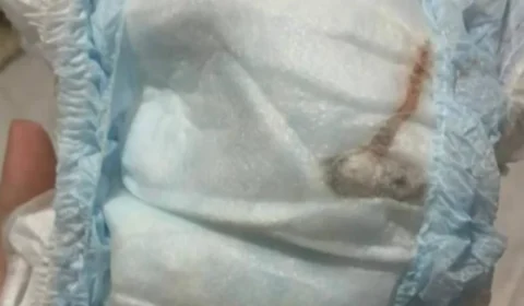 Mãe encontra rato morto em fralda de bebê no Rio de Janeiro e cobra respostas da fabricante