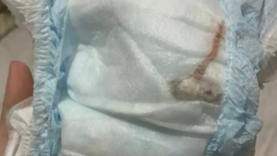 Mãe encontra rato morto em fralda de bebê no Rio de Janeiro e cobra respostas da fabricante