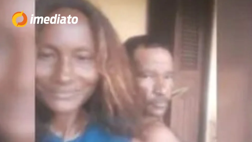 IMAGEM CHOCANTE: Mulher morre após ter 90% do corpo queimado pelo marido