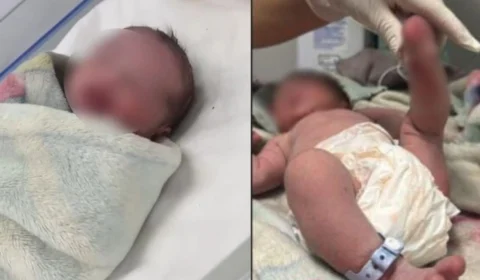 Bebê recém-nascido jogado pela janela no Mauazinho está estável e fora de risco na Maternidade Ana Braga