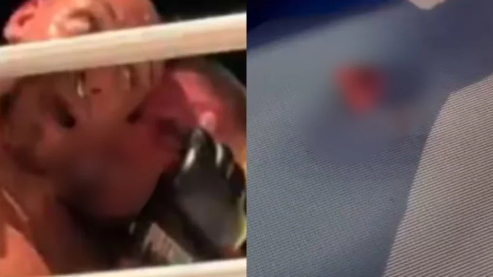 Veja o vídeo: Lutador imita Mike Tyson e arranca parte da orelha de rival à dentadas em luta de MMA
