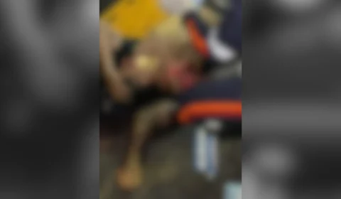 Veja a foto: Motociclista que teve braço arrancado em acidente na Zona Oeste de Manaus passa por cirurgia e está estável