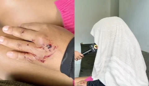 Tentativa de feminicídio: grávida é agredida com gargalo de garrafa e salva pelo filho de 11 anos