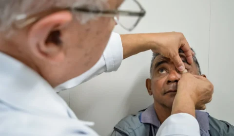 Próteses oculares são entregues a pacientes em Manaus; saiba mais