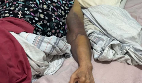 SOLIDARIEDADE: Dona Graciete precisa de ajuda após fraturar braço e perna em queda