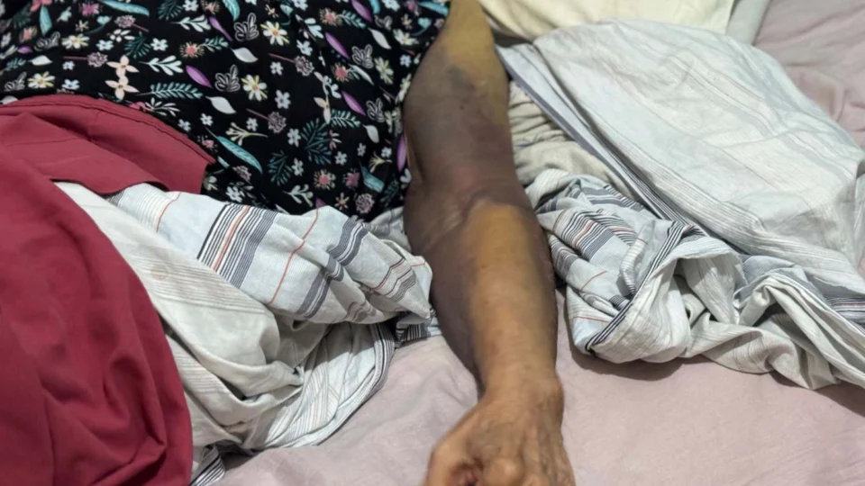 SOLIDARIEDADE: Dona Graciete precisa de ajuda após fraturar braço e perna em queda