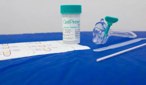 Amazonas, o epicentro do câncer do colo do útero, fica de fora da implementação inicial da testagem com tecnologia DNA-HPV