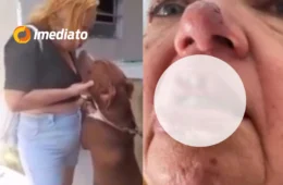 CENA FORTE: mulher tem pedaço da boca arrancado ao beijar pitbull preso por uma corrente