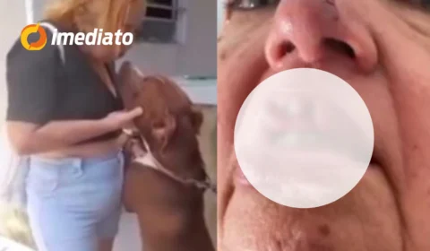 CENA FORTE: mulher tem pedaço da boca arrancado ao beijar pitbull preso por uma corrente
