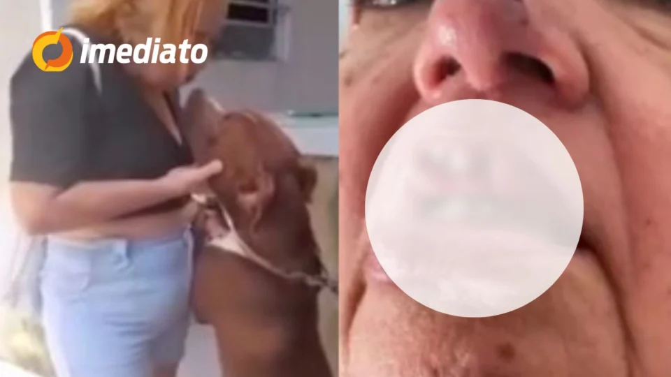 CENA FORTE: mulher tem pedaço da boca arrancado ao beijar pitbull preso por uma corrente