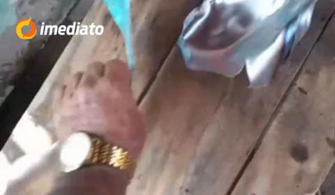 CENA FORTE: Cilindro explode e dilacera mão de trabalhador no interior do Amazonas