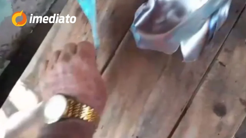 CENA FORTE: Cilindro explode e dilacera mão de trabalhador no interior do Amazonas