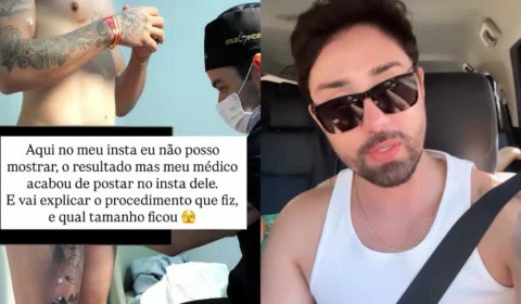 Veja o vídeo: Rico Melquiades revela procedimento íntimo e diz ter ganhado 3 cm de comprimento; ‘Resultado imediato’, diz