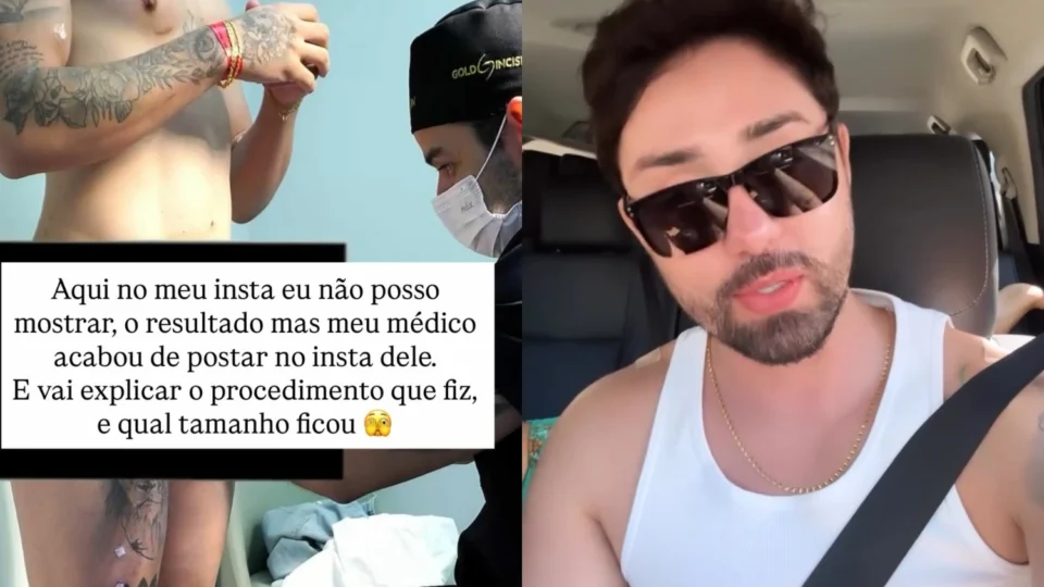 Veja o vídeo: Rico Melquiades revela procedimento íntimo e diz ter ganhado 3 cm de comprimento; ‘Resultado imediato’, diz