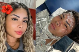 Foto: Jovem grávida de dois meses sofre queimaduras em incêndio no Distrito Industrial e está estável em hospital de Manaus