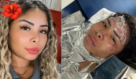 Foto: Jovem grávida de dois meses sofre queimaduras em incêndio no Distrito Industrial e está estável em hospital de Manaus