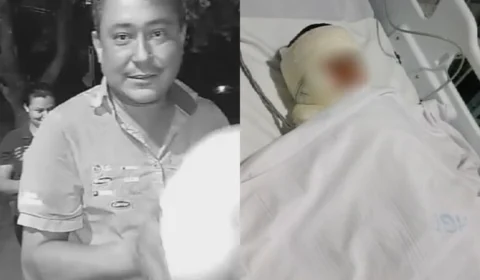 Veja o vídeo: Criança de 5 anos sofre queimaduras graves após explosão durante churrasco em Palmas;  Adulto morreu