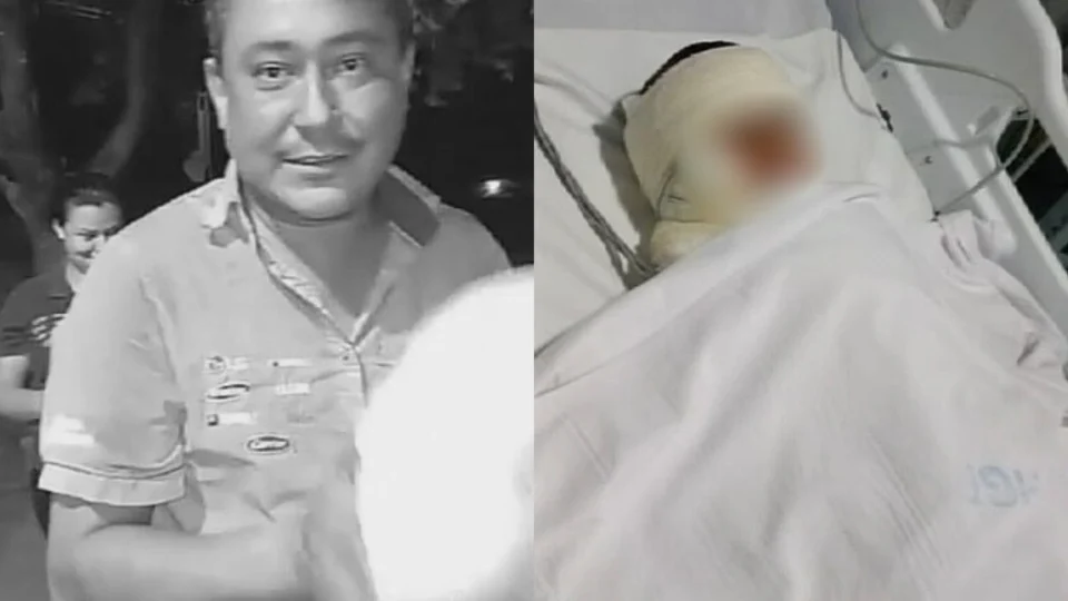 Veja o vídeo: Criança de 5 anos sofre queimaduras graves após explosão durante churrasco em Palmas;  Adulto morreu