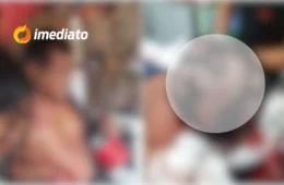 CENA FORTE: homem tem couro cabeludo dilacerado após sofrer ataque de onça no Amazonas