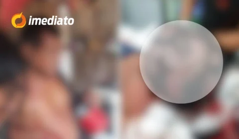 CENA FORTE: homem tem couro cabeludo dilacerado após sofrer ataque de onça no Amazonas