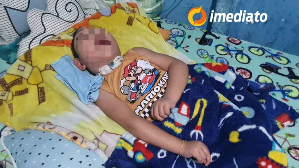 Mãe pede ajuda para adaptar escada de casa e garantir acessibilidade ao filho com microcefalia e paralisia cerebral em Manaus