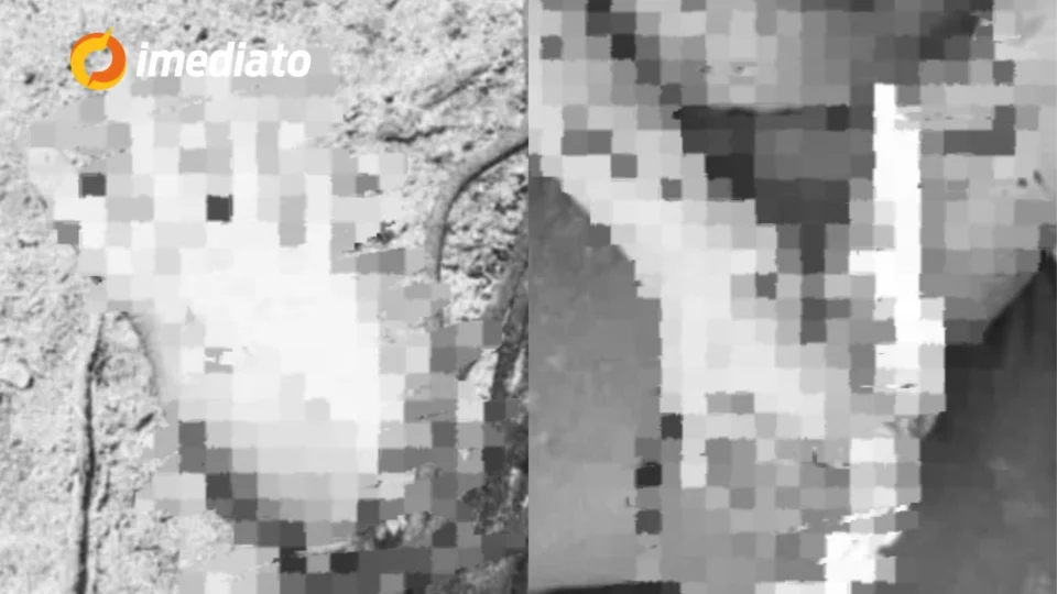 Homem dá entrada em hospital de Maués com mão decepada após possível ataque no garimpo