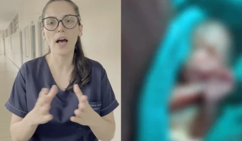 Veja o vídeo: Pediatra detalha situação rara de bebê prematuro que voltou a apresentar sinais vitais após óbito declarado