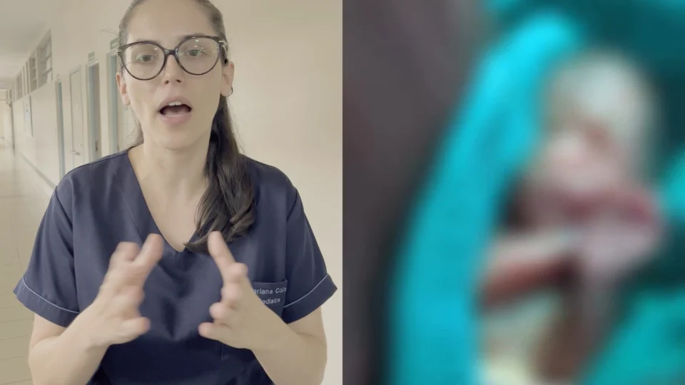 Veja o vídeo: Pediatra detalha situação rara de bebê prematuro que voltou a apresentar sinais vitais após óbito declarado