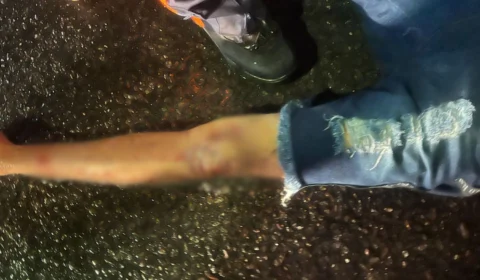 Imagens fortes: Motociclista morre após colidir com carro no conjunto Renato Souza Pinto