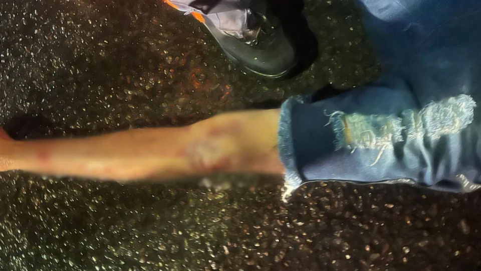 Imagens fortes: Motociclista morre após colidir com carro no conjunto Renato Souza Pinto