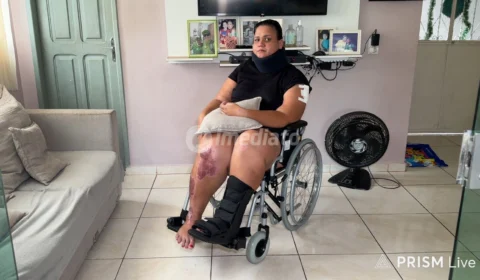 Mulher de 31 anos sofre acidente causado por motorista desgovernada e pede justiça